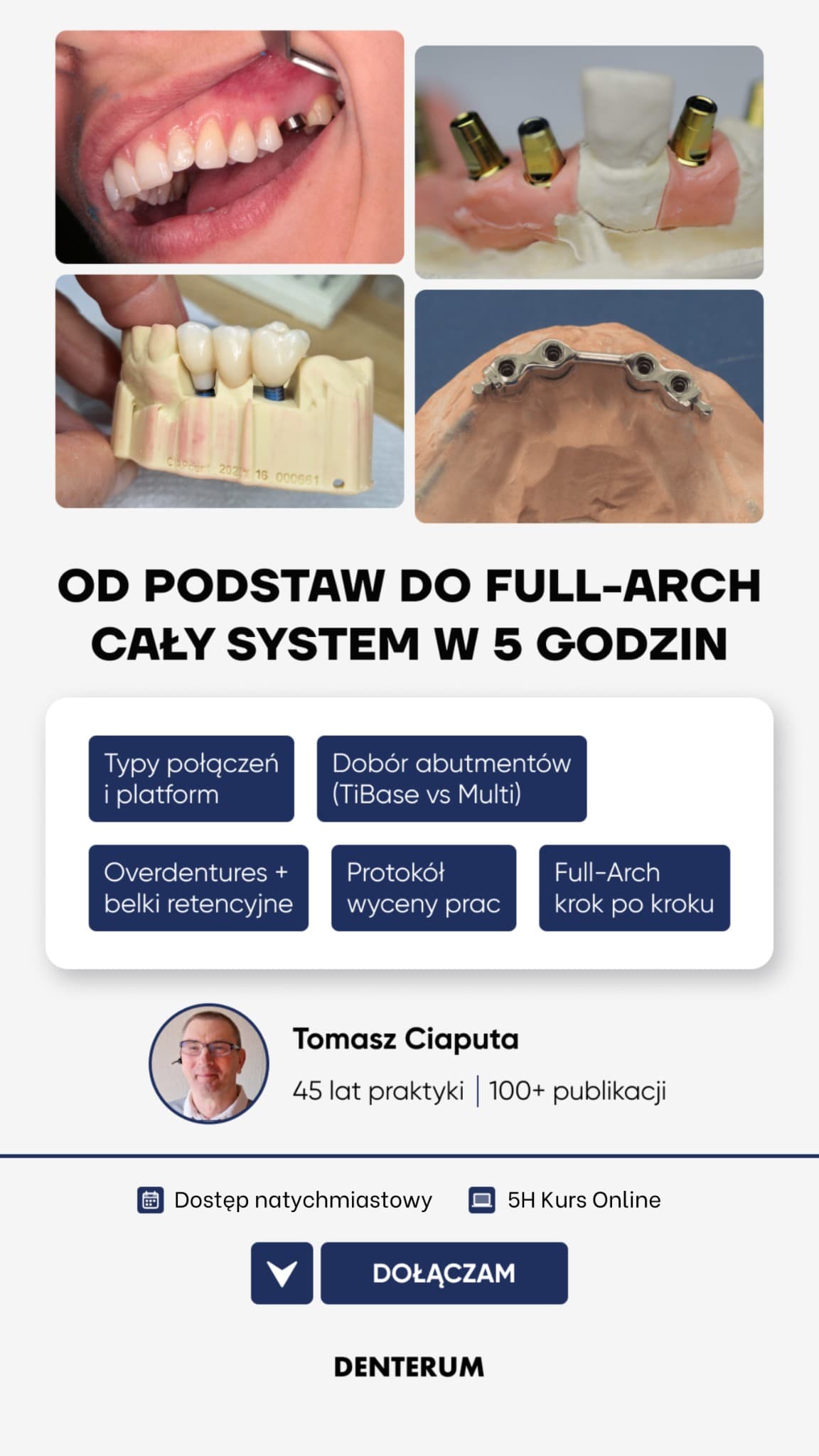 Ad by Denterum