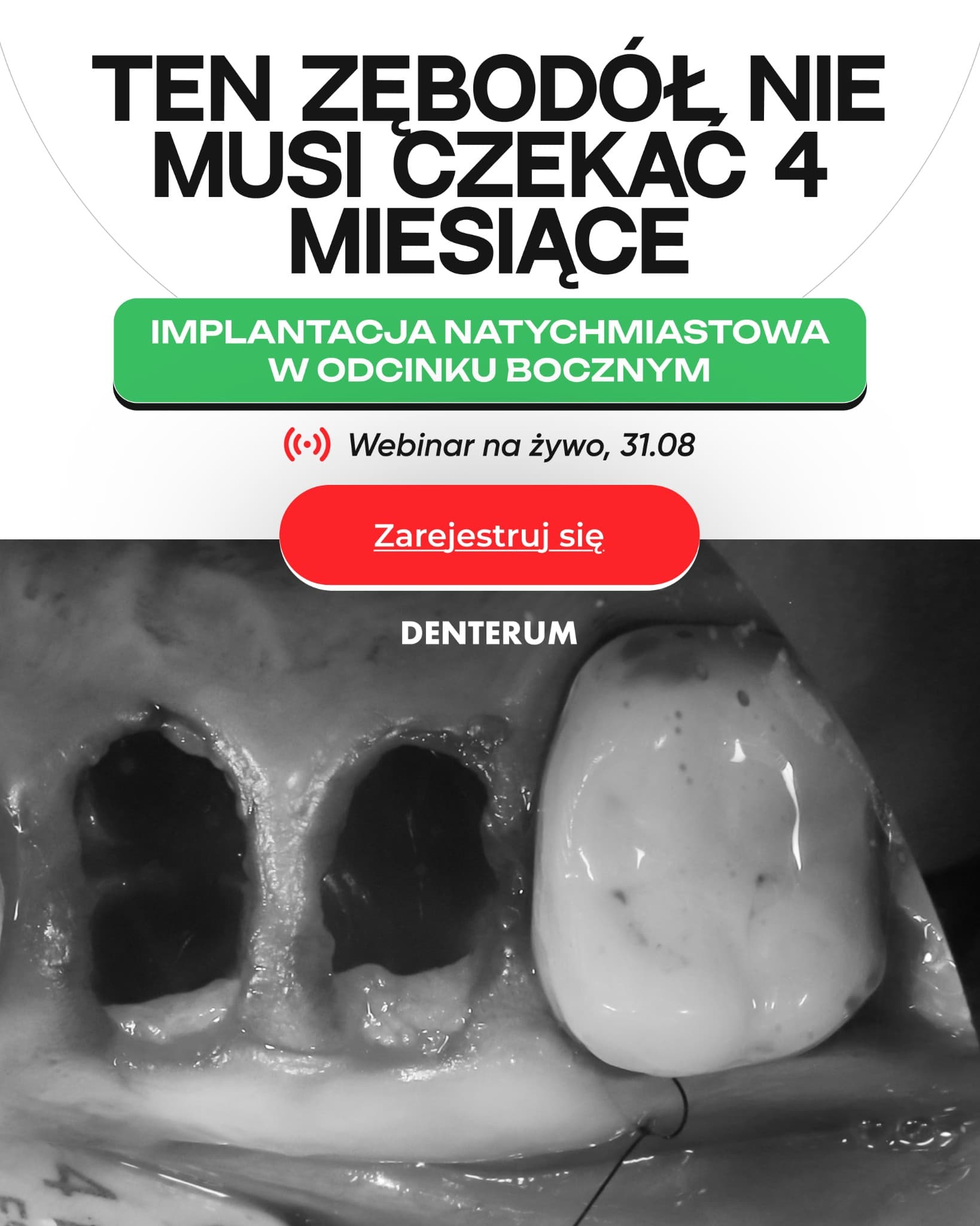 Denterum ad creative, July 2026