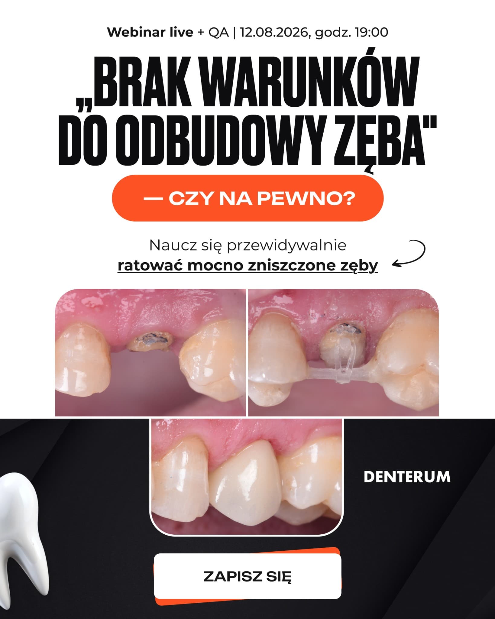 Denterum ad creative, July 2026