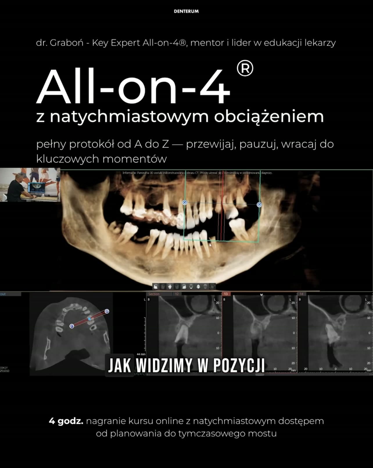 Denterum ad creative, July 2026