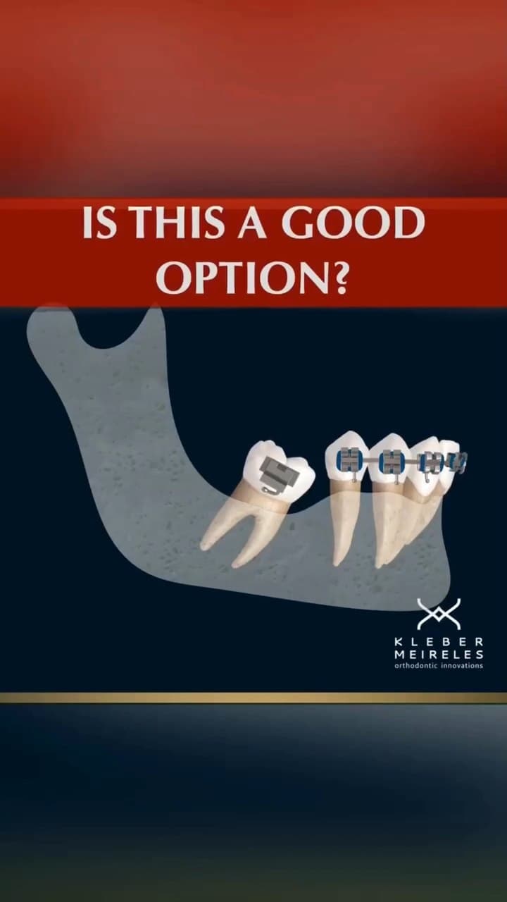 Facebook ad by Prof. Kleber Meireles